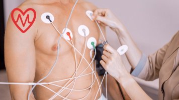 Holter krvnog pritiska