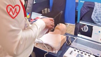 Transezofagealni ultrazvuk srca