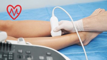 Kolor dupleks donjih ekstremiteta